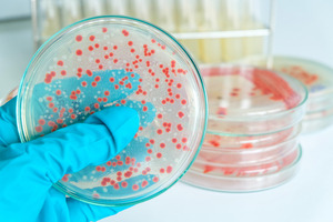 Bacterial growth on solid culture medium - © Tinydevil / shutterstock.com