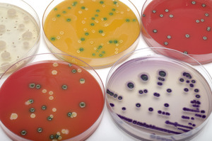 Detection of pathogens - © villorejo / Adobe Stock